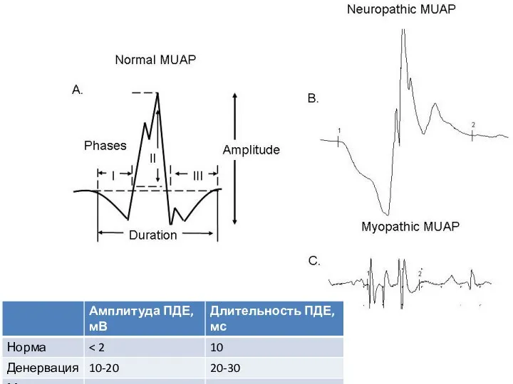 При нейропатиях вследствие нарушения иннервации изменяется чувствительность к АЦХ, повышается возбудимость мышечных