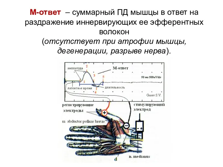 М-ответ – суммарный ПД мышцы в ответ на раздражение иннервирующих ее эфферентных