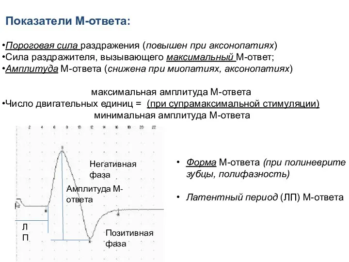 Показатели М-ответа: Пороговая сила раздражения (повышен при аксонопатиях) Сила раздражителя, вызывающего максимальный