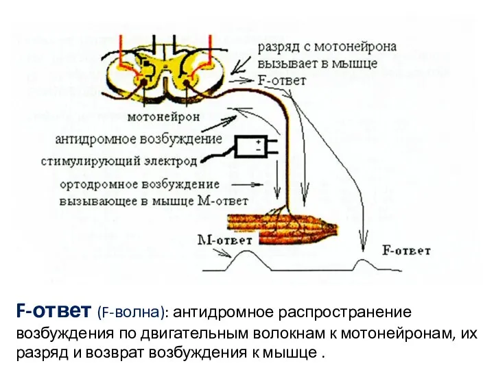 F-ответ (F-волна): антидромное распространение возбуждения по двигательным волокнам к мотонейронам, их разряд