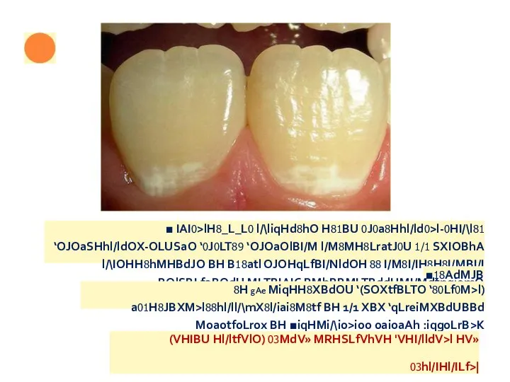 ■ IAI0>lH8_L_L0 l/\liqHd8hO H81BU 0J0a8Hhl/ld0>l-0HI/\l81 ‘OJOaSHhl/ldOX-OLUSaO ‘0J0LT89 ‘OJOaOlBI/M l/M8MH8LratJ0U 1/1 SXIOBhA l/\IOHH8hMHBdJO