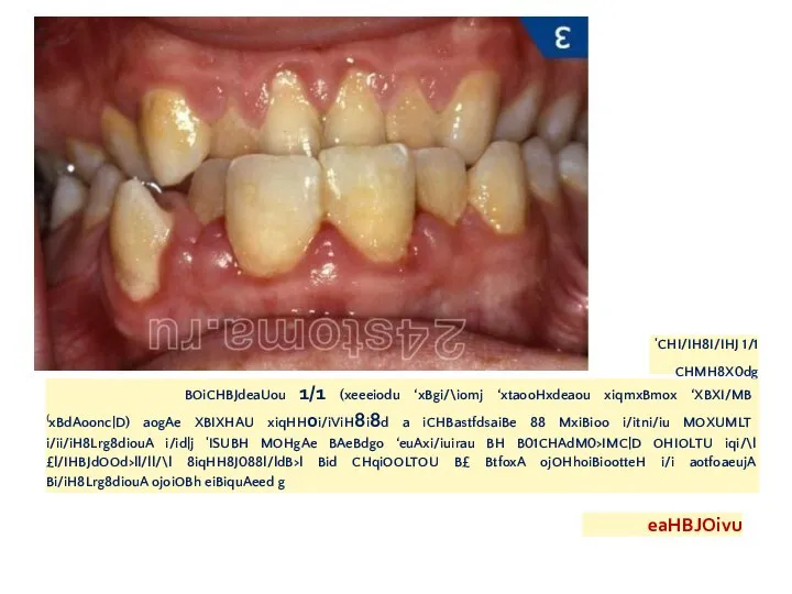 'CHI/IH8I/IHJ 1/1 CHMH8X0dg BOiCHBJdeaUou 1/1 (xeeeiodu ‘xBgi/\iomj ‘xtaooHxdeaou xiqmxBmox ‘XBXI/MB (xBdAoonc|D) aogAe