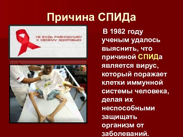 Причина СПИДа В 1982 году ученым удалось выяснить, что причиной СПИДа является