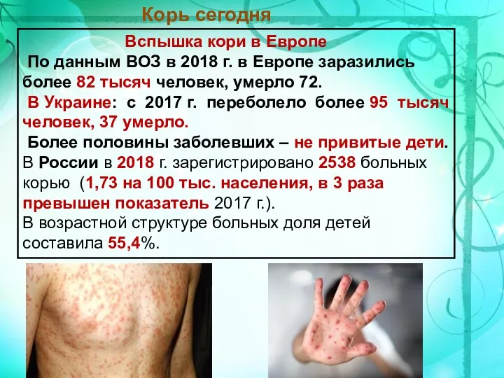 Вспышка кори в Европе По данным ВОЗ в 2018 г. в Европе