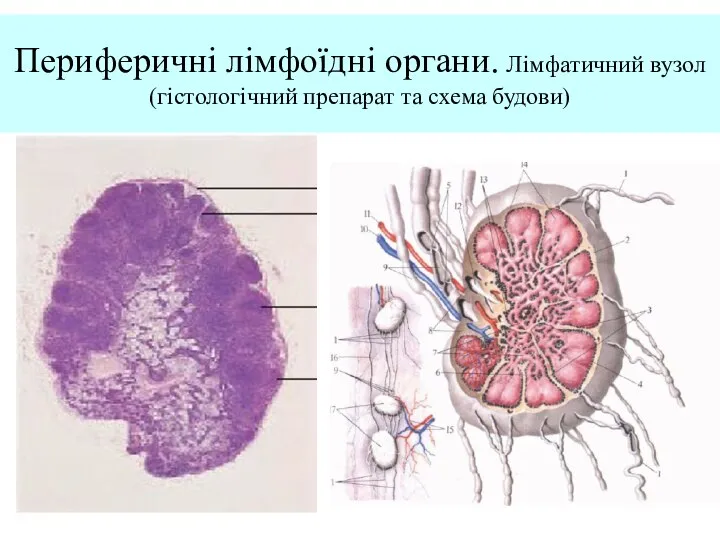 Периферичні лімфоїдні органи. Лімфатичний вузол (гістологічний препарат та схема будови)