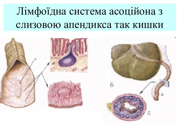 Лімфоїдна система асоційона з слизовою апендикса так кишки