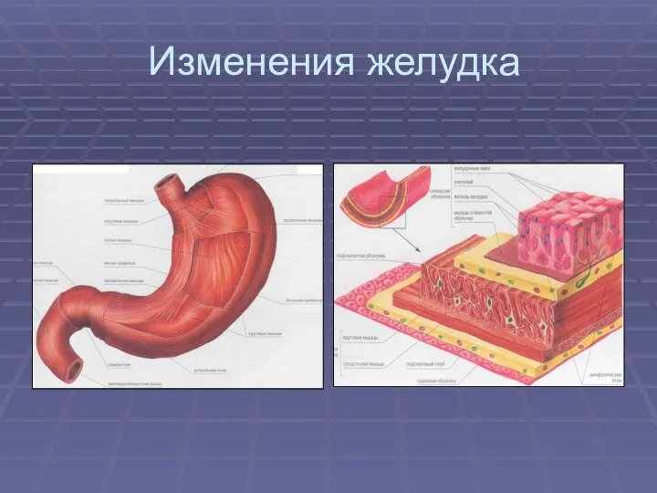 Изменения желудка