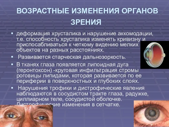 ВОЗРАСТНЫЕ ИЗМЕНЕНИЯ ОРГАНОВ ЗРЕНИЯ деформация хрусталика и нарушение аккомодации, т.е. способность хрусталика