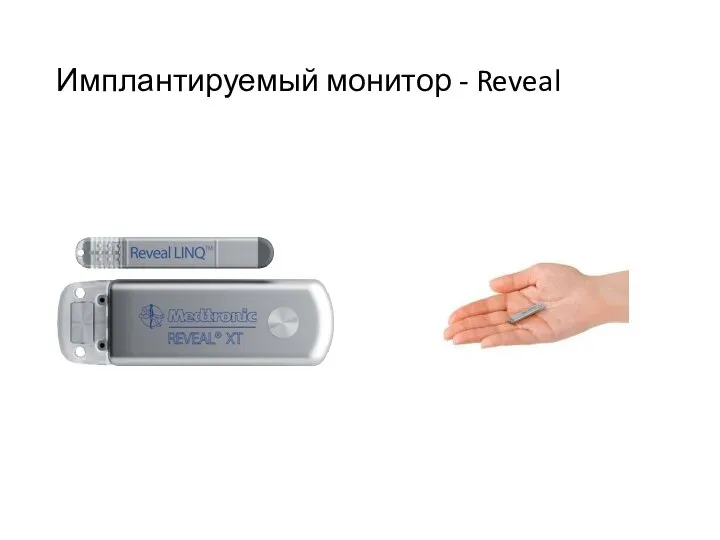 Имплантируемый монитор - Reveal