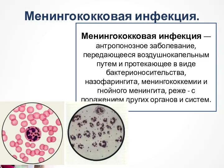 Менингококковая инфекция. Менингококковая инфекция –– антропонозное заболевание, передающееся воздушнокапельным путем и протекающее