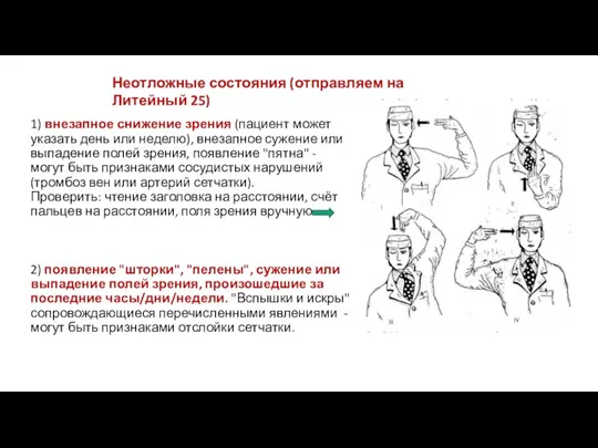 1) внезапное снижение зрения (пациент может указать день или неделю), внезапное сужение