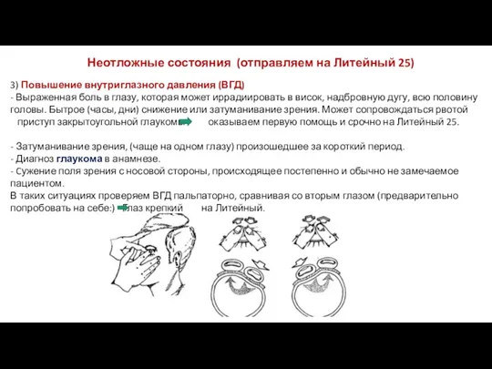 Неотложные состояния (отправляем на Литейный 25) 3) Повышение внутриглазного давления (ВГД) -