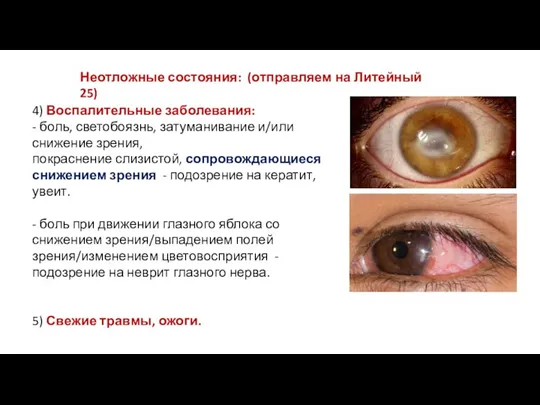 4) Воспалительные заболевания: - боль, светобоязнь, затуманивание и/или снижение зрения,​ покраснение слизистой,