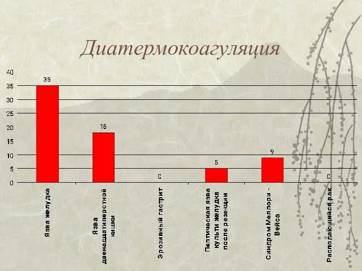 Диатермокоагуляция