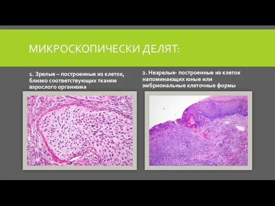 МИКРОСКОПИЧЕСКИ ДЕЛЯТ: 1. Зрелые – построенные из клеток, близко соответствующих тканям взрослого