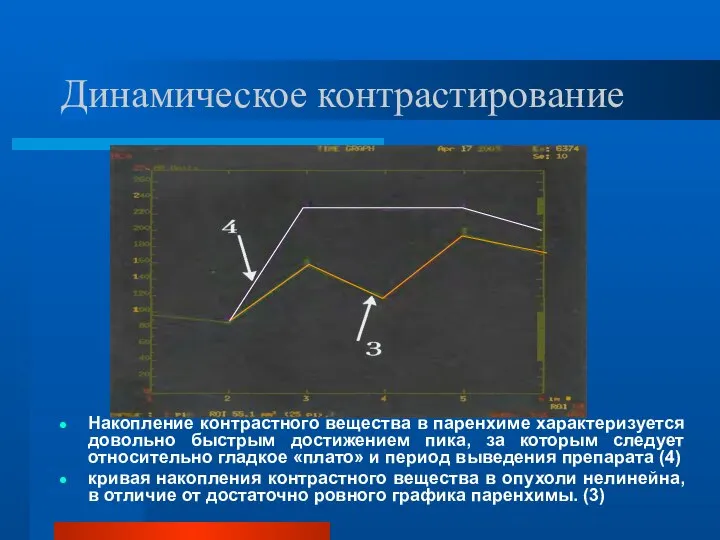 Динамическое контрастирование Накопление контрастного вещества в паренхиме характеризуется довольно быстрым достижением пика,