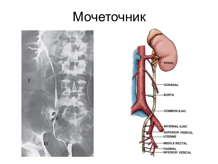 Мочеточник