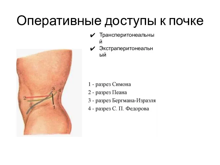 Оперативные доступы к почке Трансперитонеальный Экстраперитонеальный