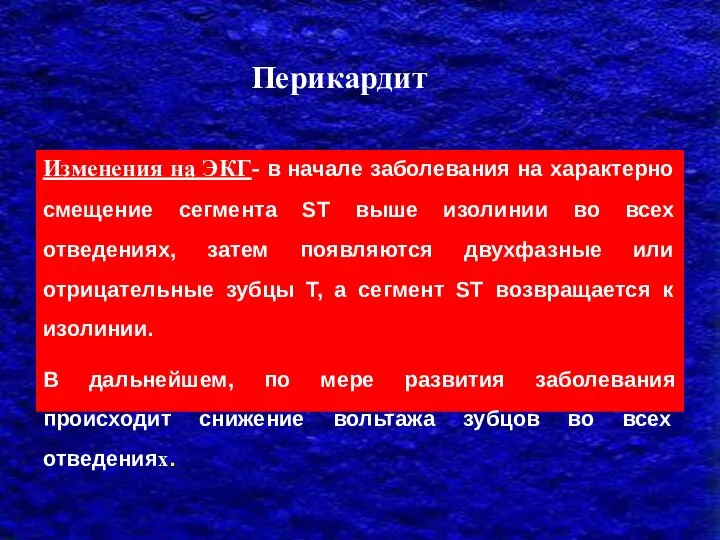 Изменения на ЭКГ- в начале заболевания на характерно смещение сегмента ST выше