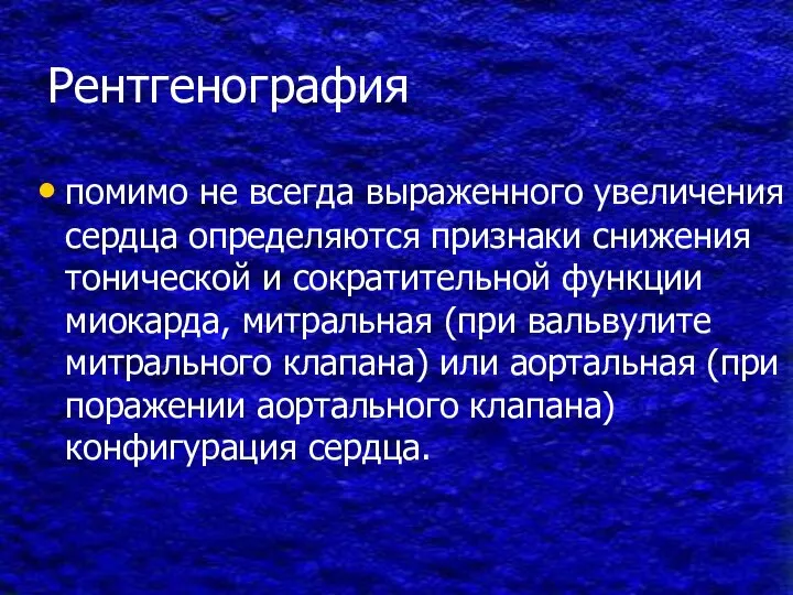 Рентгенография помимо не всегда выраженного увеличения сердца определяются признаки снижения тонической и