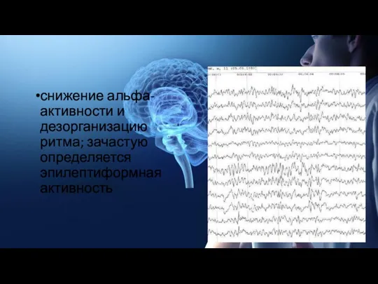 снижение альфа-активности и дезорганизацию ритма; зачастую определяется эпилептиформная активность