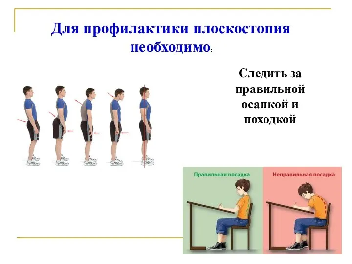 Для профилактики плоскостопия необходимо: Следить за правильной осанкой и походкой