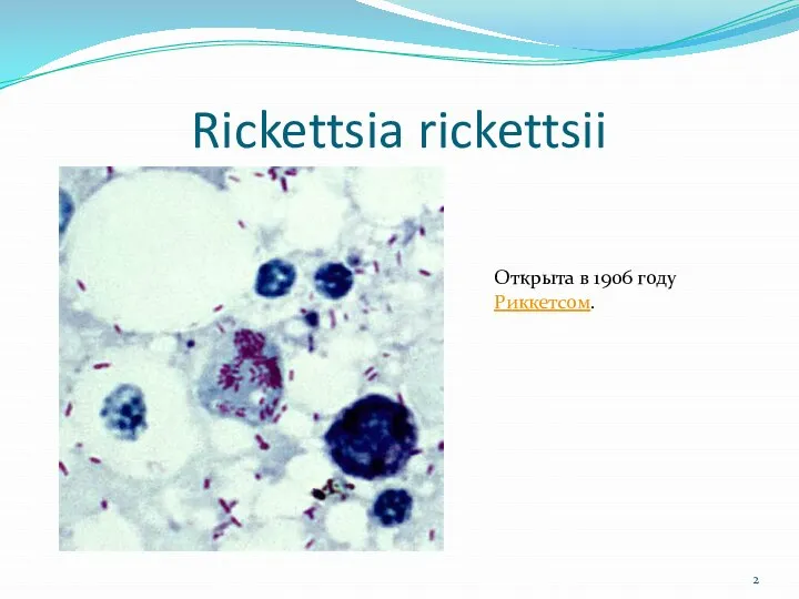 Rickettsia rickettsii Открыта в 1906 году Риккетсом.