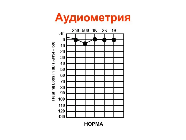 Аудиометрия НОРМА