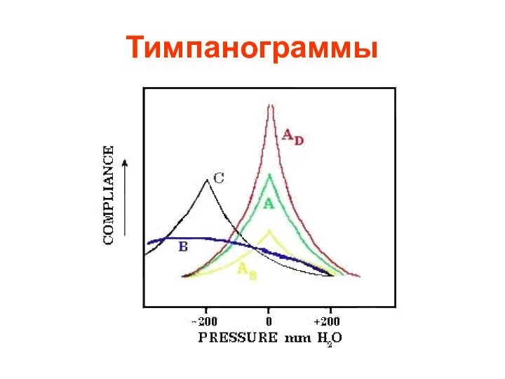 Тимпанограммы