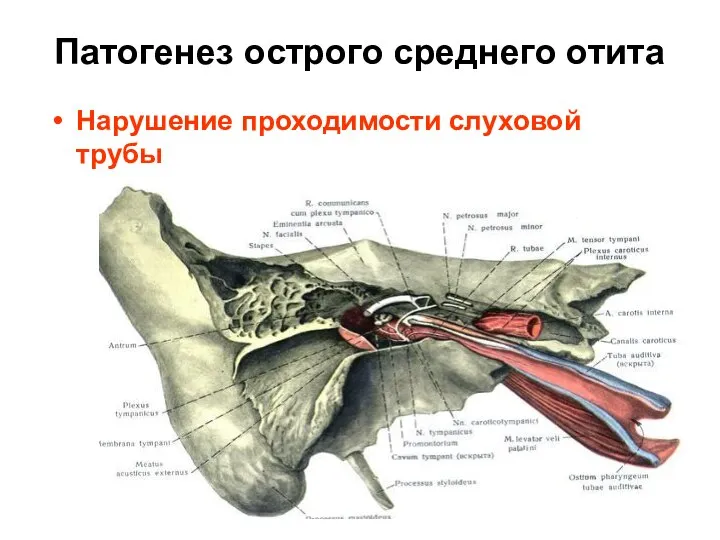 Патогенез острого среднего отита Нарушение проходимости слуховой трубы