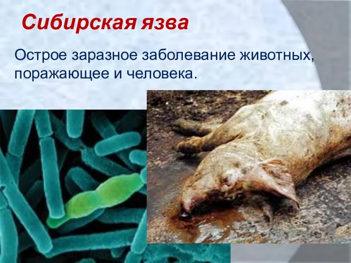 Сибирская язва Острое заразное заболевание животных, поражающее и человека..
