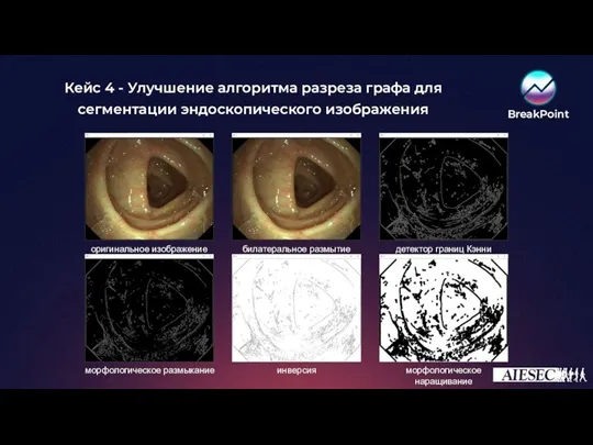 Кейс 4 - Улучшение алгоритма разреза графа для сегментации эндоскопического изображения билатеральное