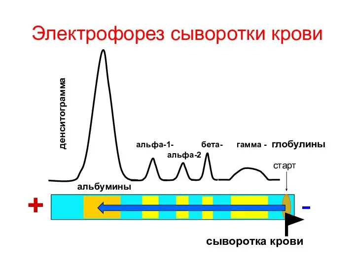 Электрофорез сыворотки крови + - старт денситограмма альбумины альфа-1- бета- гамма - глобулины альфа-2 сыворотка крови