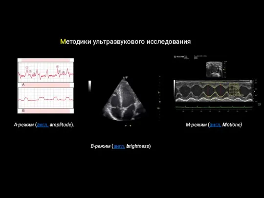 Методики ультразвукового исследования A-режим (англ. amplitude). B-режим (англ. brightness) M-режим (англ. Motionе)