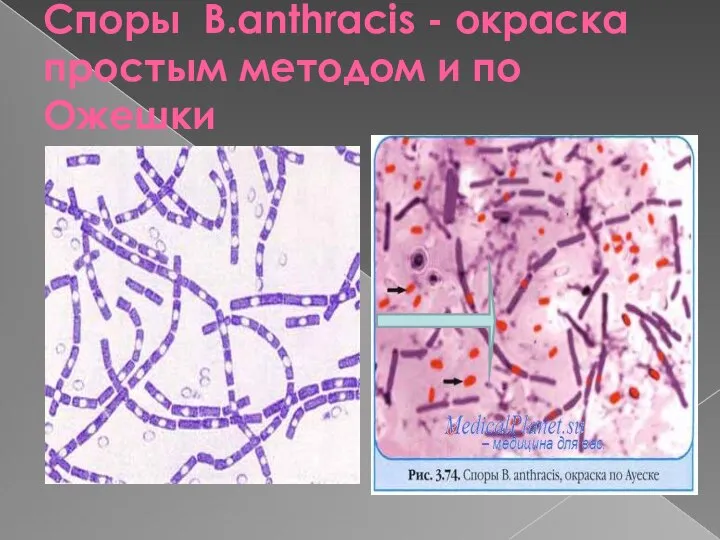 Споры B.anthracis - окраска простым методом и по Ожешки