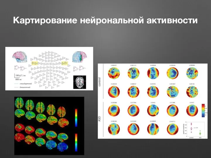 Картирование нейрональной активности