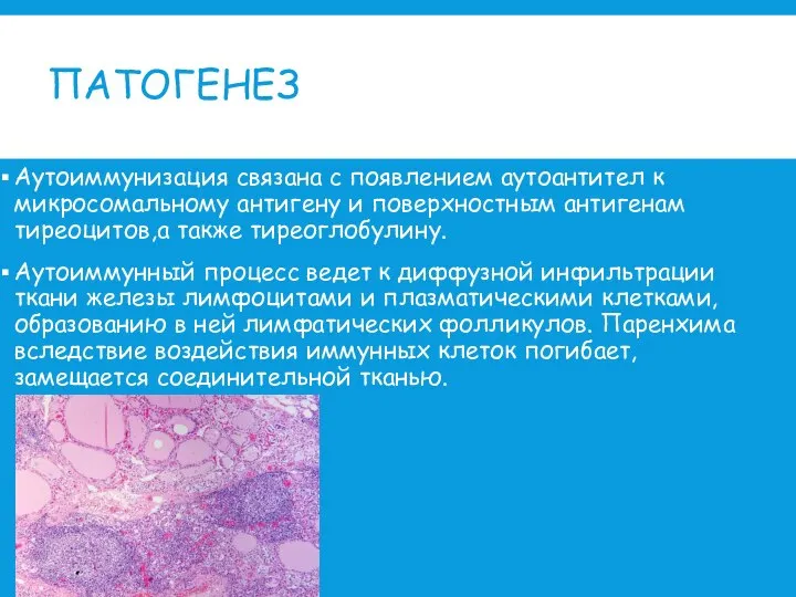 ПАТОГЕНЕЗ Аутоиммунизация связана с появлением аутоантител к микросомальному антигену и поверхностным антигенам