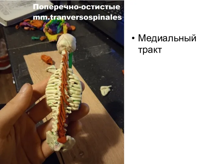 Медиальный тракт