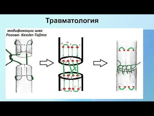 Травматология