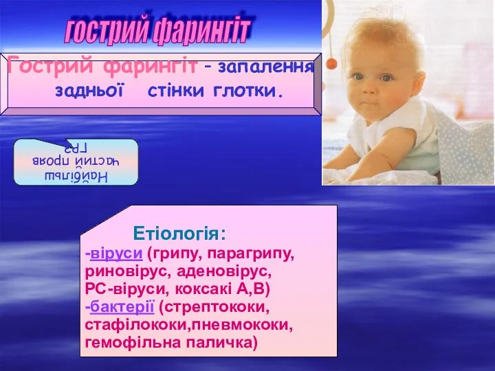 Гострий фарингіт - запалення задньої стінки глотки. гострий фарингіт Найбільш частий прояв