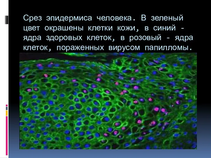 Срез эпидермиса человека. В зеленый цвет окрашены клетки кожи, в синий -
