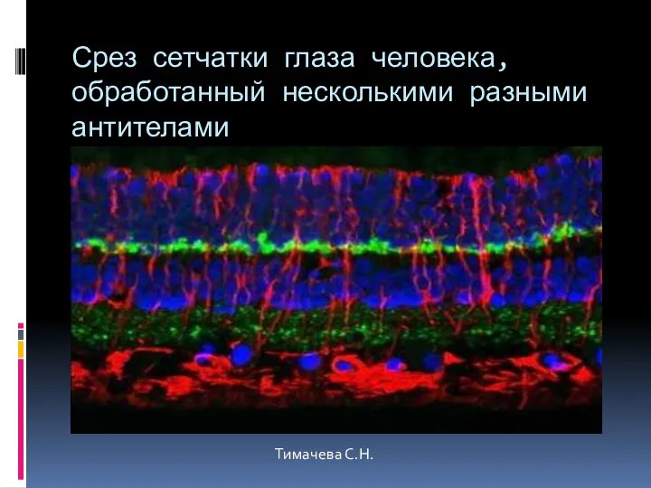 Срез сетчатки глаза человека, обработанный несколькими разными антителами Тимачева С.Н.