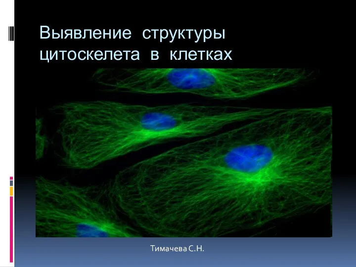 Выявление структуры цитоскелета в клетках Тимачева С.Н.