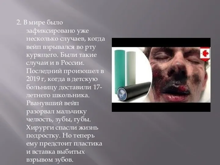 2. В мире было зафиксировано уже несколько случаев, когда вейп взрывался во