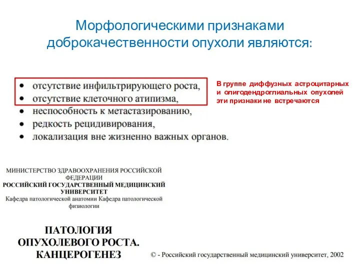 Морфологическими признаками доброкачественности опухоли являются: В группе диффузных астроцитарных и олигодендроглиальных опухолей эти признаки не встречаются