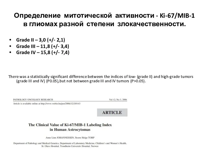 Определение митотической активности - Ki-67/MIB-1 в глиомах разной степени злокачественности. Grade II