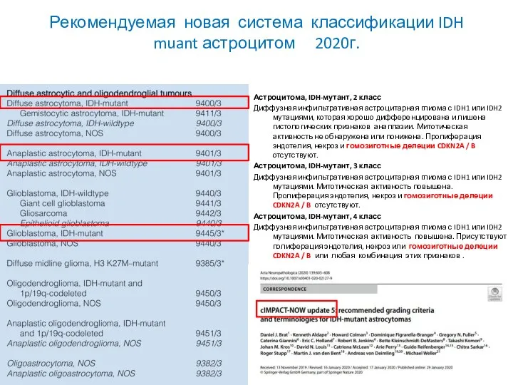 Рекомендуемая новая система классификации IDH muant астроцитом 2020г. Астроцитома, IDH-мутант, 2 класс