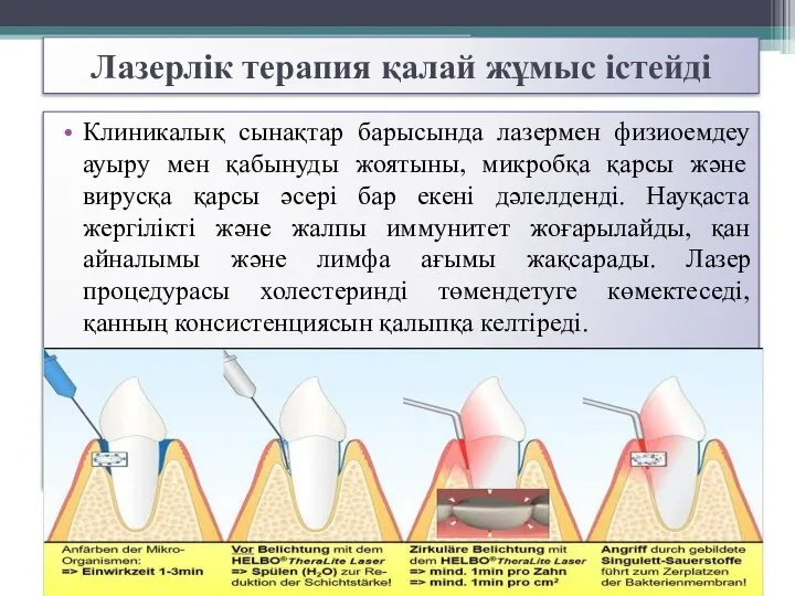 Лазерлік терапия қалай жұмыс істейді Клиникалық сынақтар барысында лазермен физиоемдеу ауыру мен