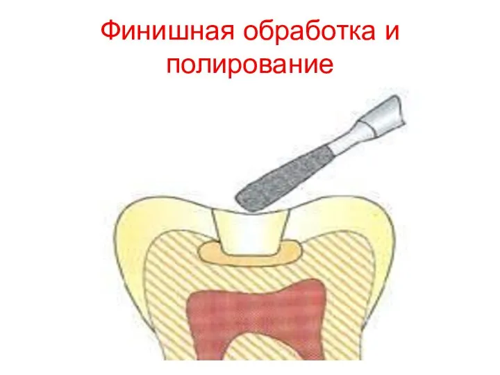 Финишная обработка и полирование