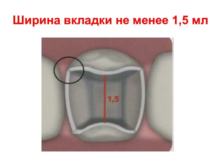 Ширина вкладки не менее 1,5 мл